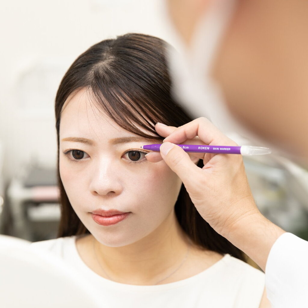 目元の美容整形のデザインをしている様子