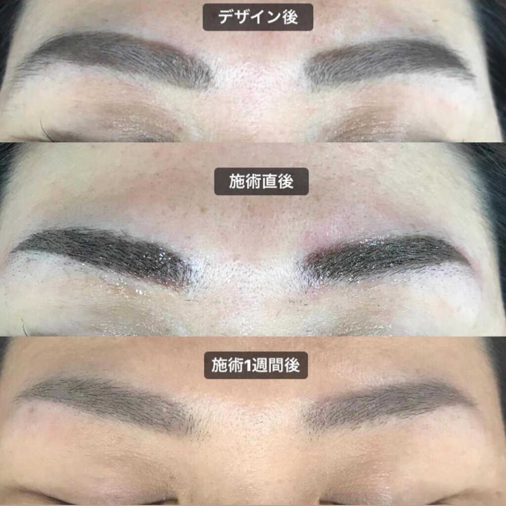 眉毛のデザインから術後の症例写真