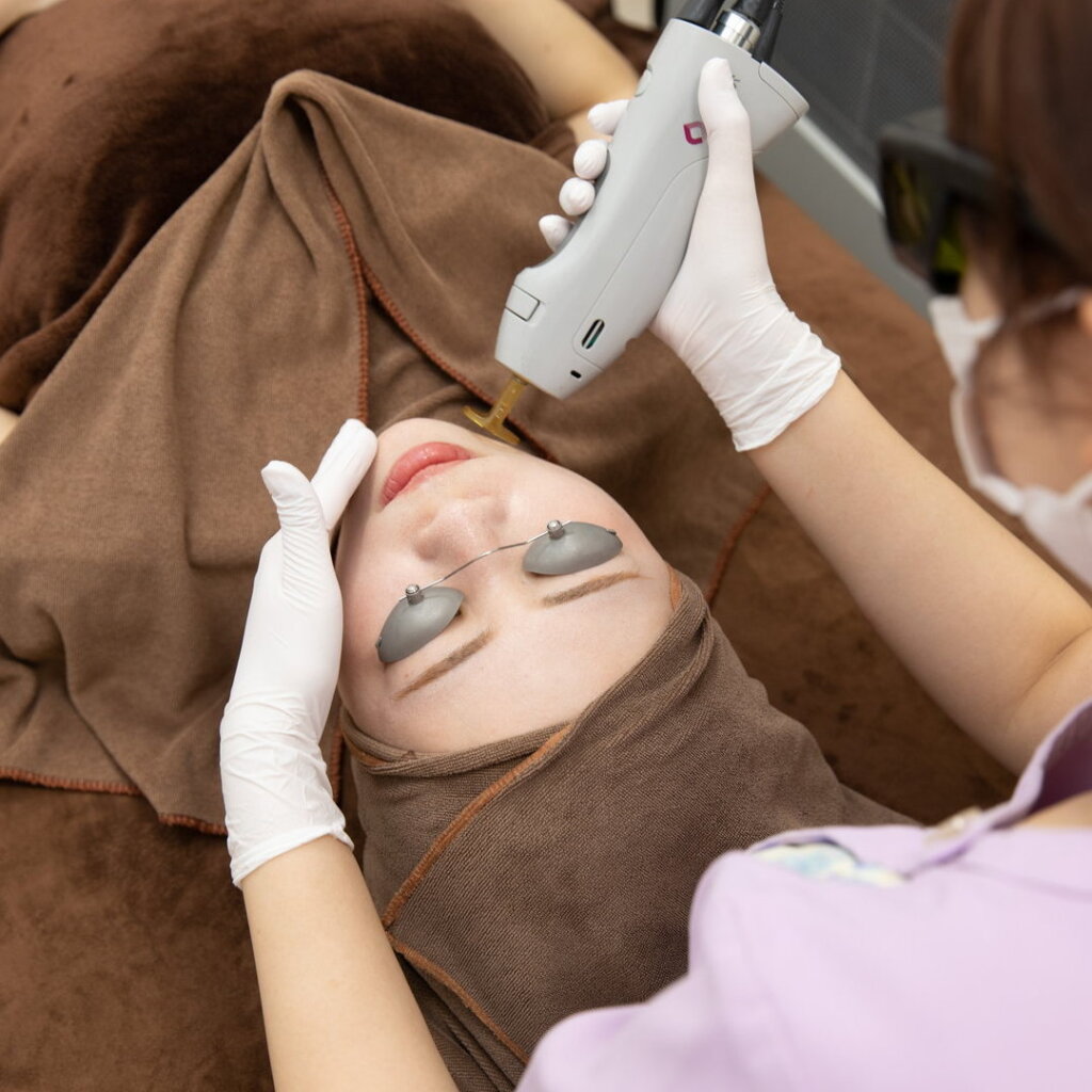 脱毛の施術をしている様子