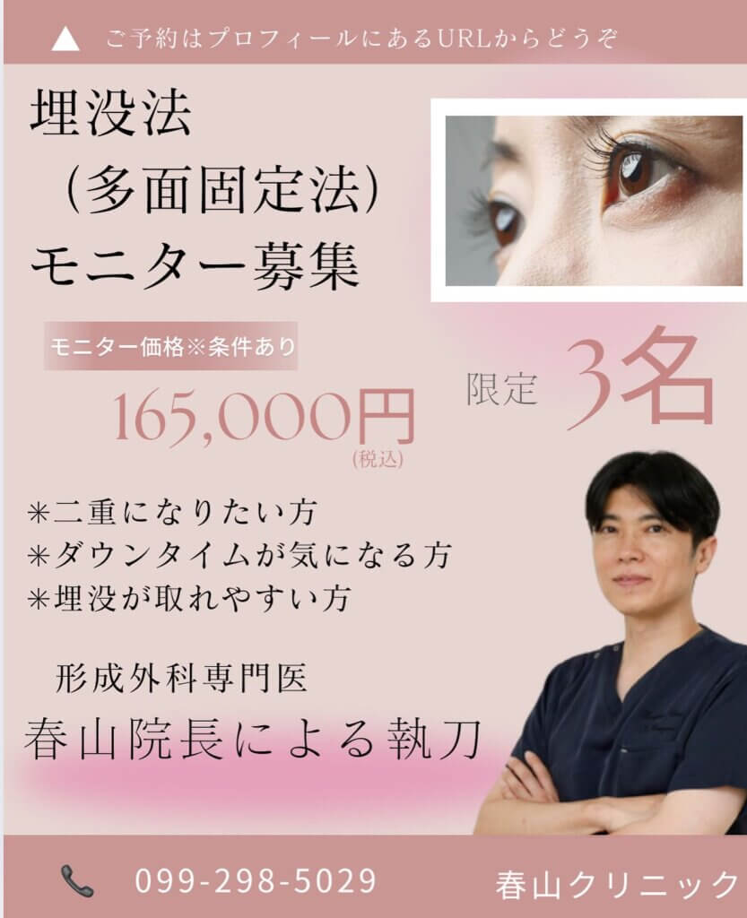 鹿児島の埋没法のモニター募集のバナー