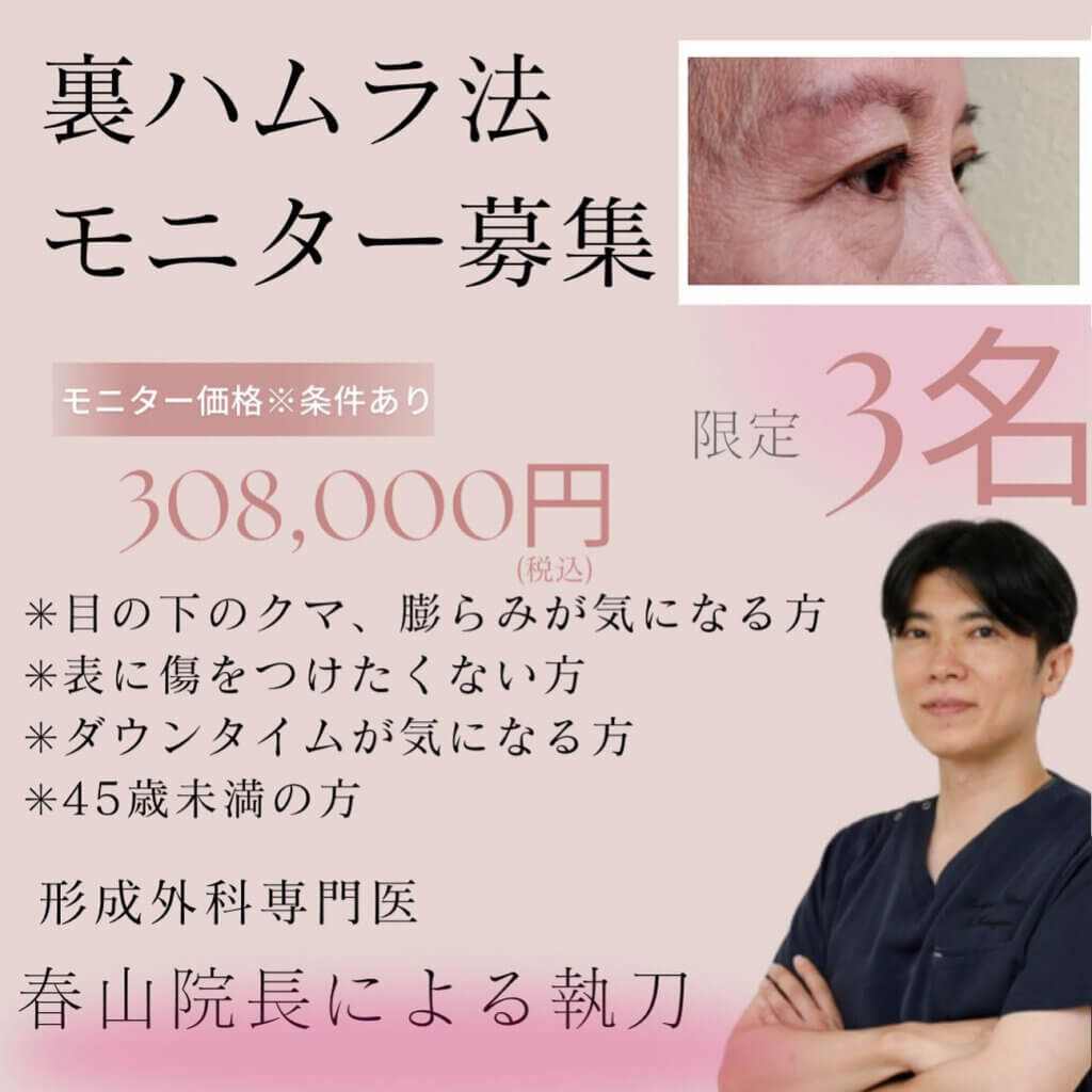 鹿児島の裏ハムラのモニター募集バナー