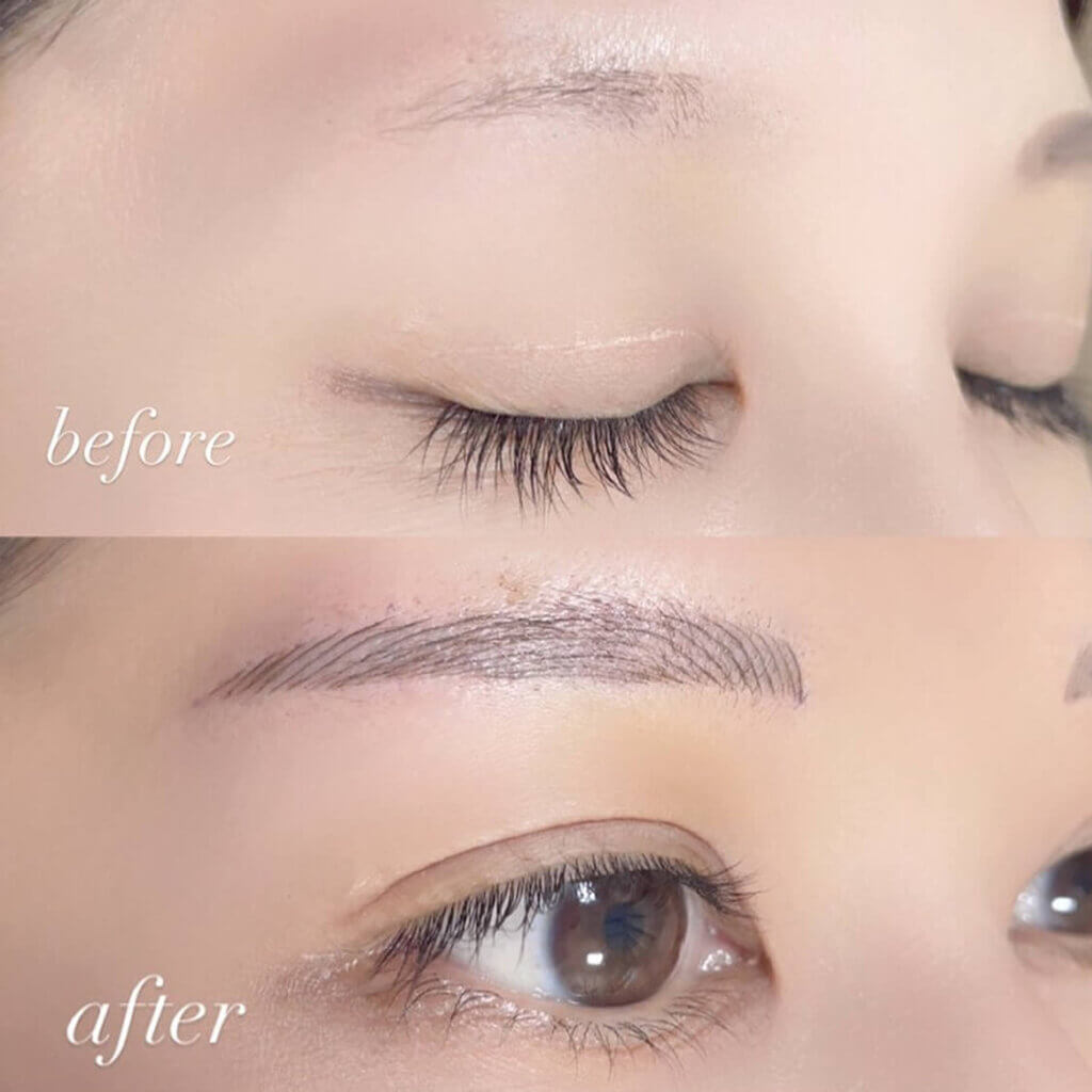 眉のアートメイクの症例写真 (14)