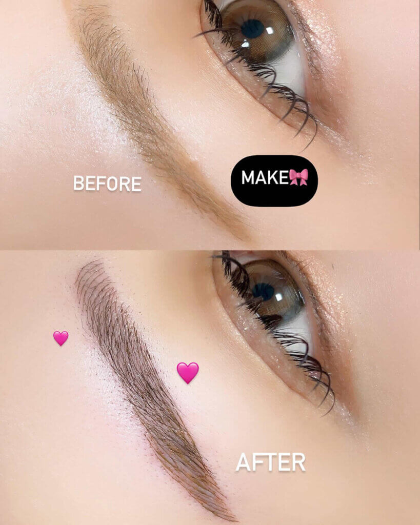 眉のアートメイクの症例写真 (2)