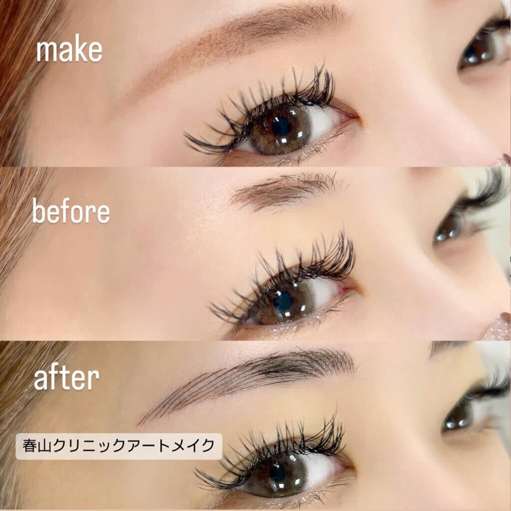 眉のアートメイクの症例写真 (8)