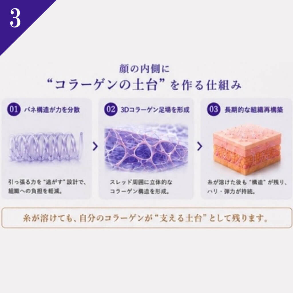 NーJAMBER（ジェンバー）スレッドの説明 ③
