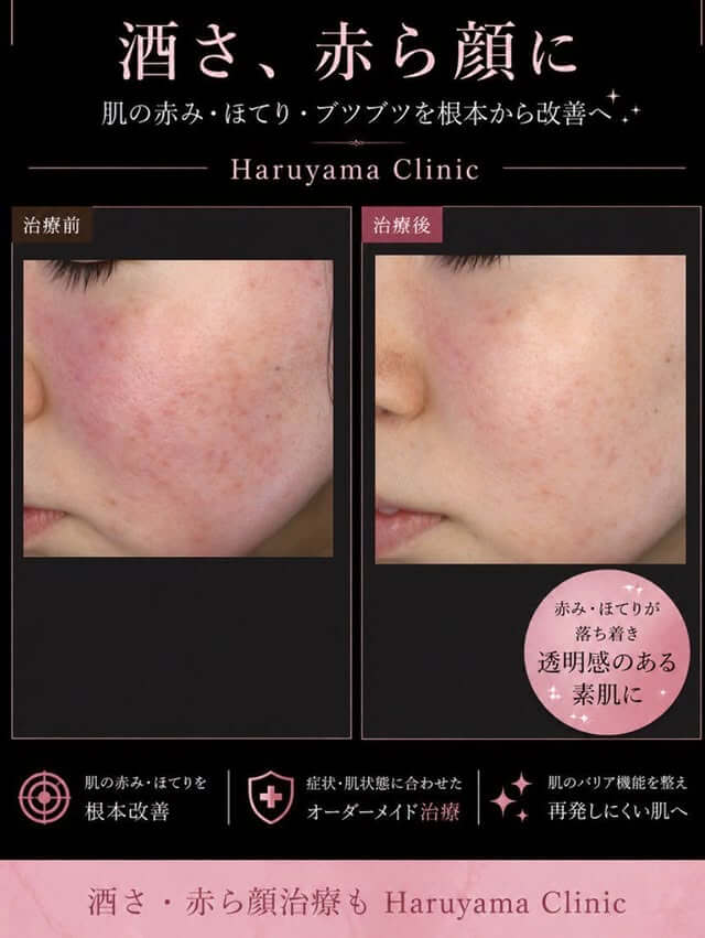 赤ら顔の紹介 (2)