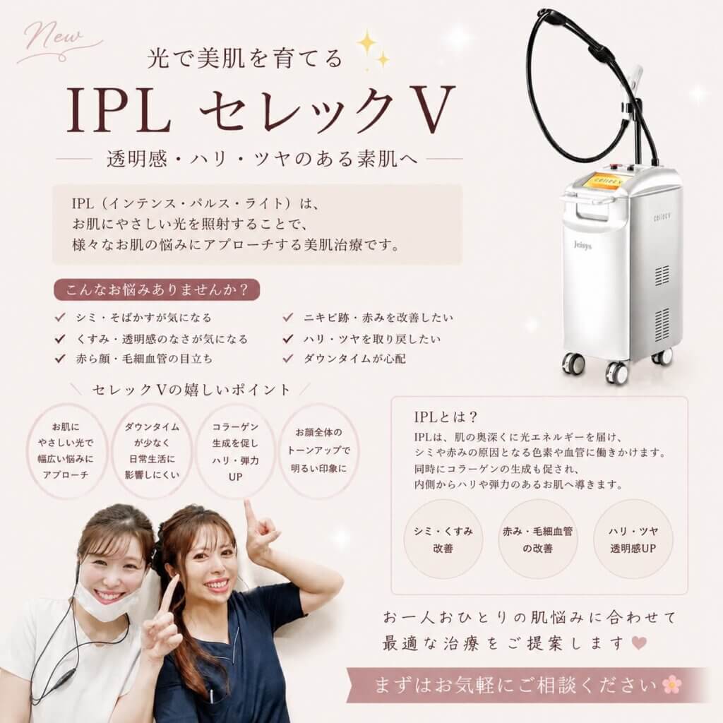 セレックVの説明