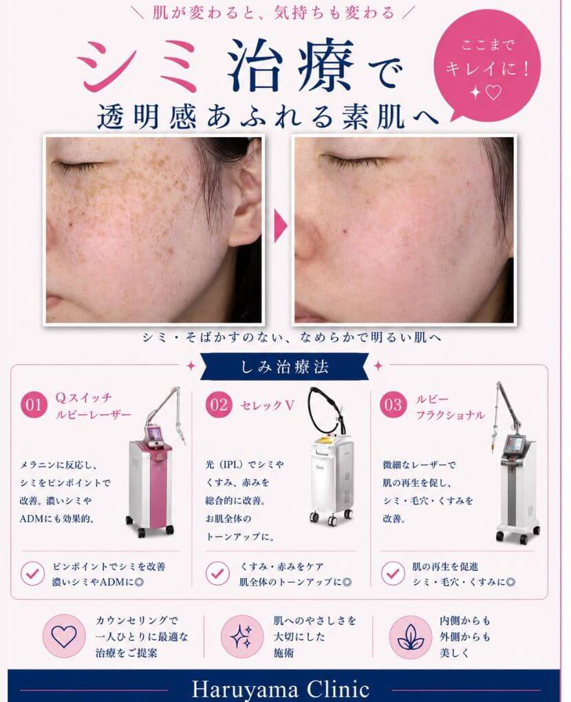 シミ治療の説明